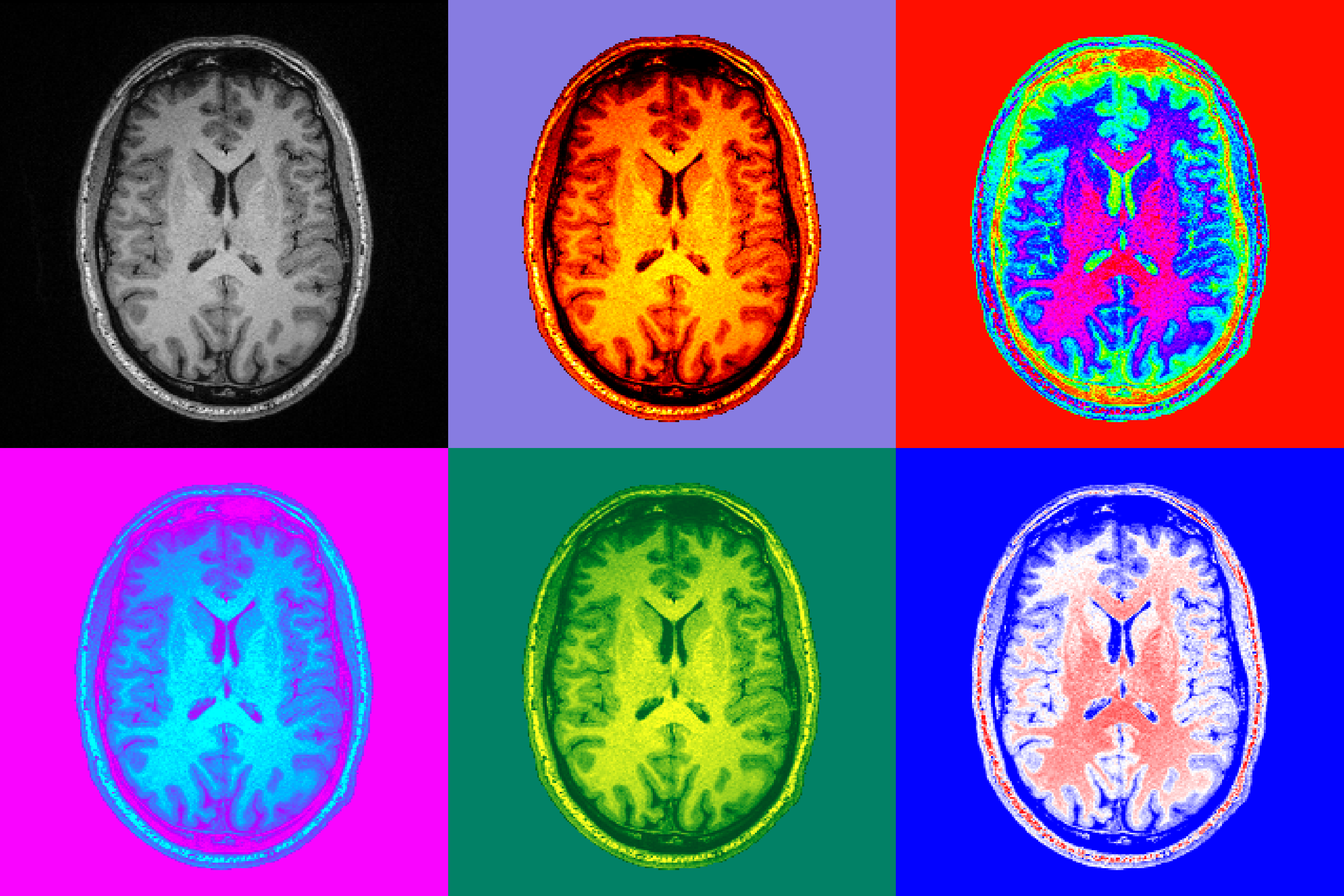 6 imágenes de un cerebro humano, cada una destacando una región específica en diferentes colores brillantes